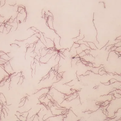 Borrelia бактерии