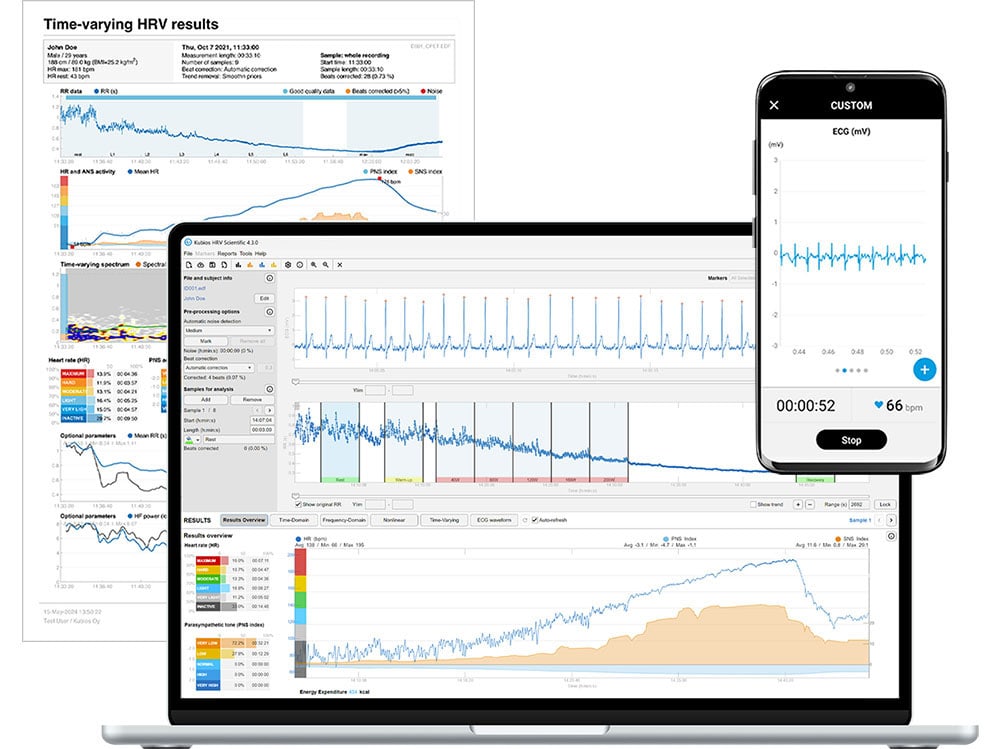 HRV analysis