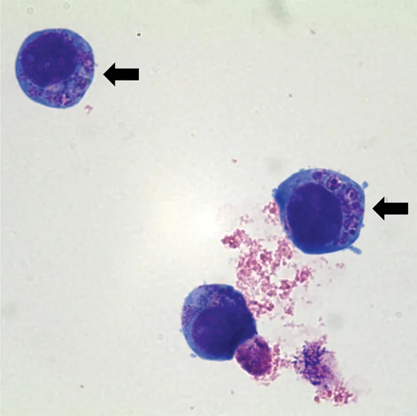 Anaplasma phagocytophilum в култура от човешки клетки (HL-60) под микроскоп