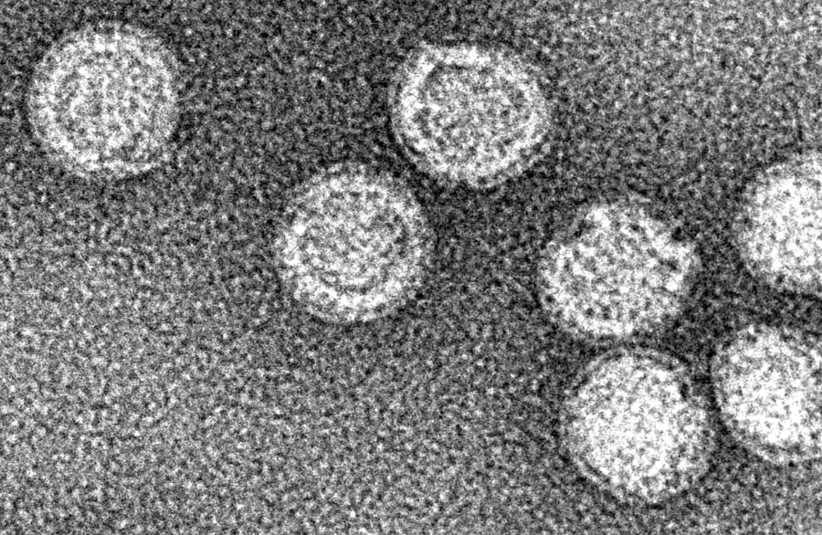Частици на вируса на кърлежовия енцефалит под електронен микроскоп